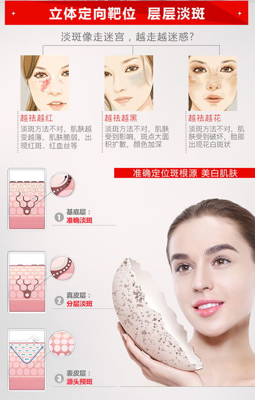 美白祛斑霜正品黄褐斑雀斑晒斑妊娠斑老年斑各种色斑祛斑产品30g